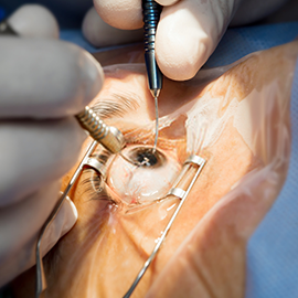  advanced sutureless cataract surgery in mulund