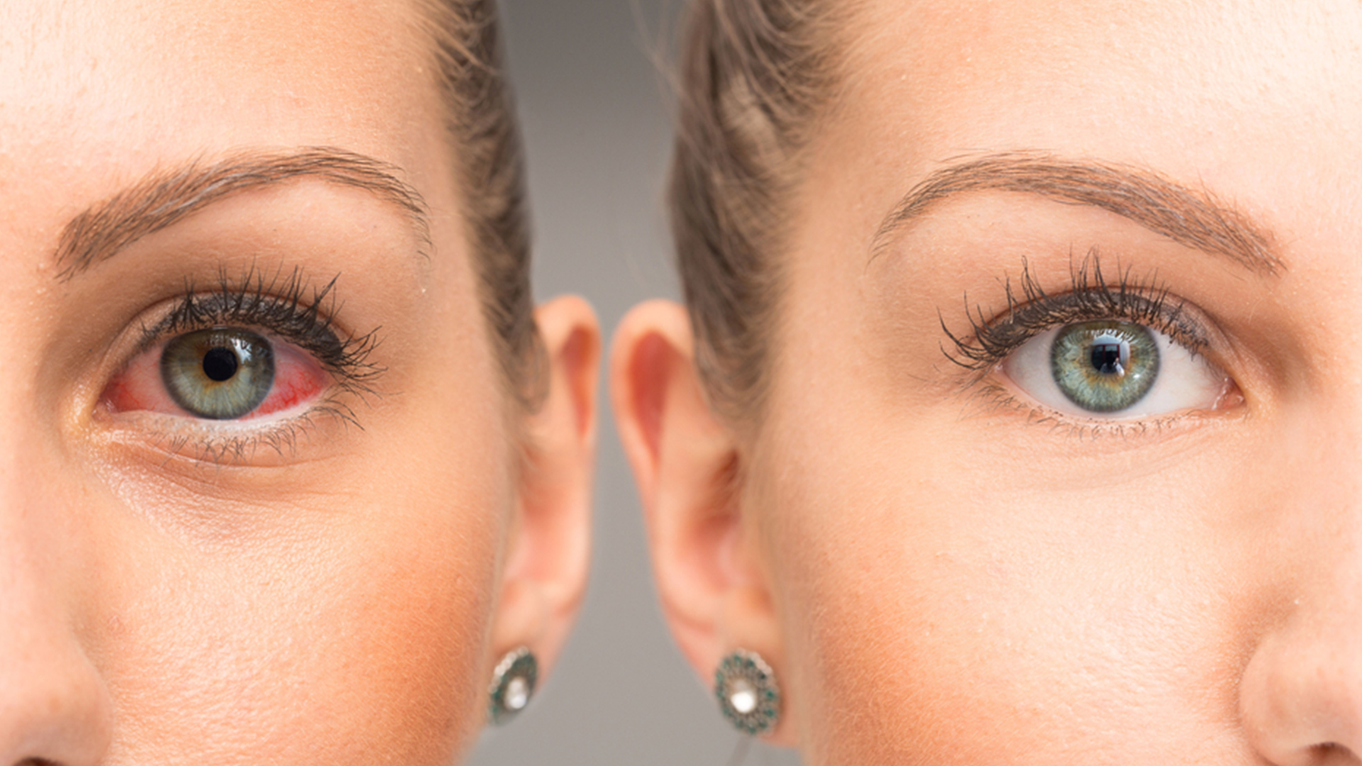 dry eye treatment in mulund