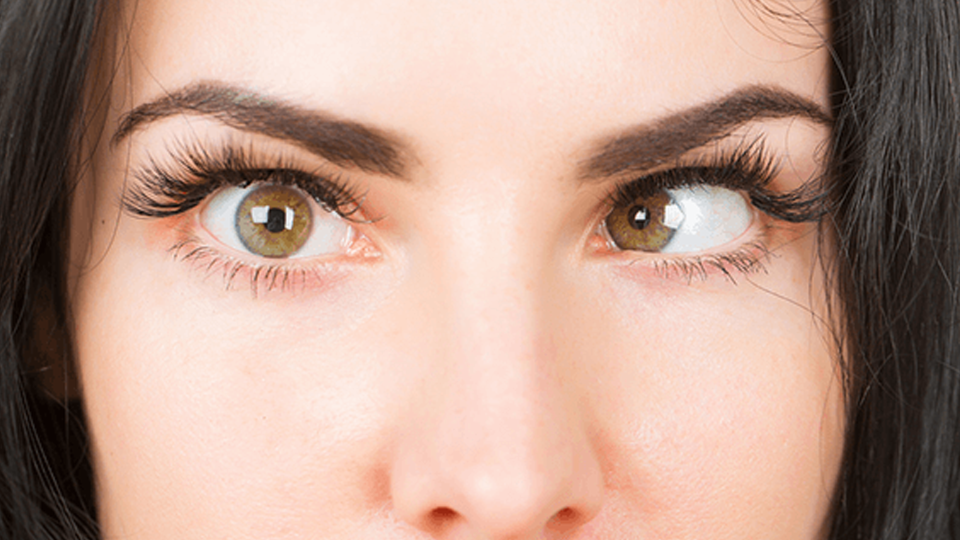 strabismus squint eye treatment in mulund