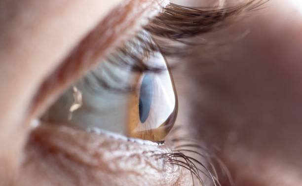 Best Cornea Transplant Hospital in Mulund